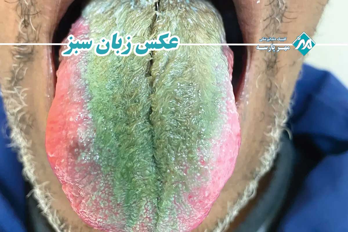 عکس زبان سبز