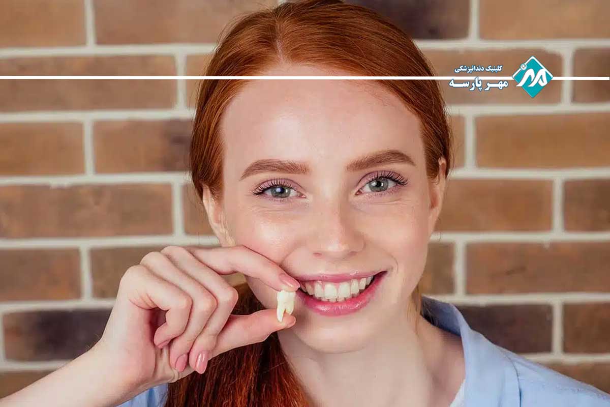 پریکورونیت (Pericoronitis): عفونت دردناک لثه روی دندان نیمه‌نهفته