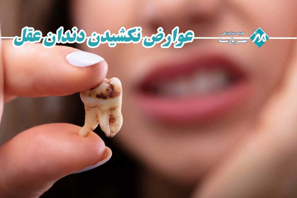 عوارض پنهان و خطرناک نکشیدن دندان عقل