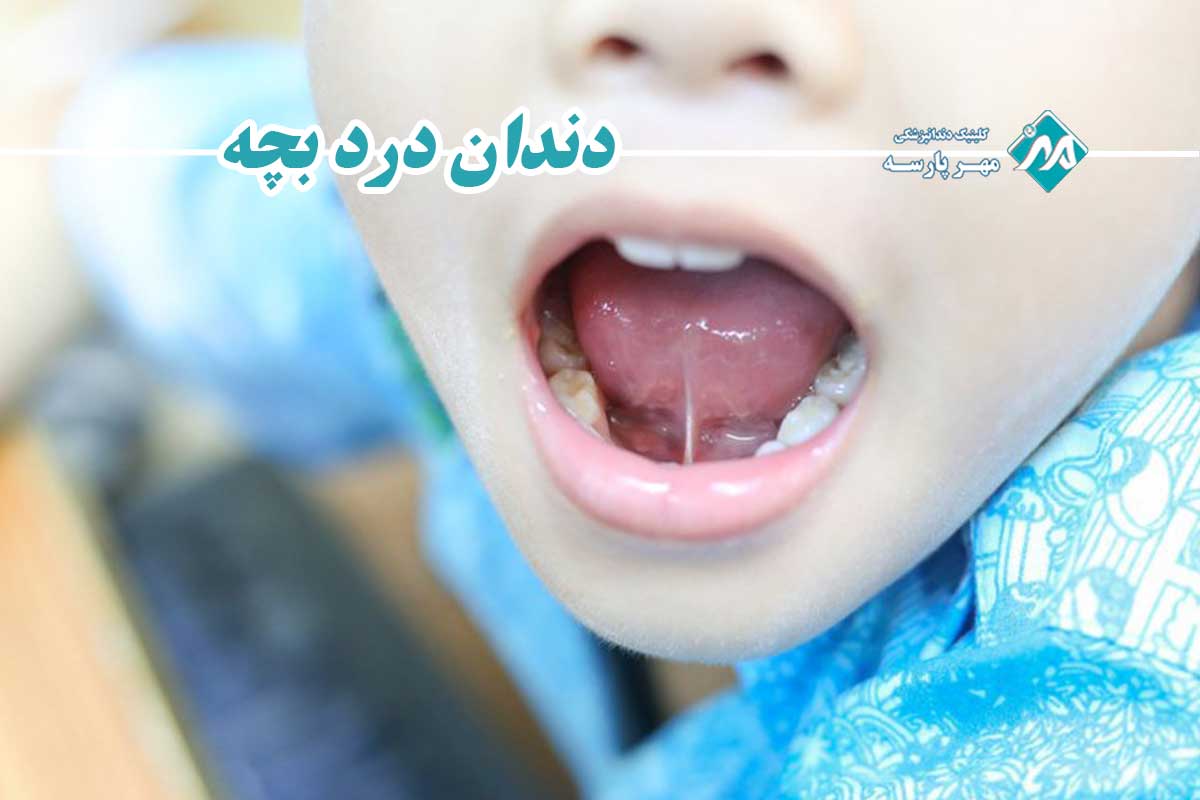 دندان درد بچه