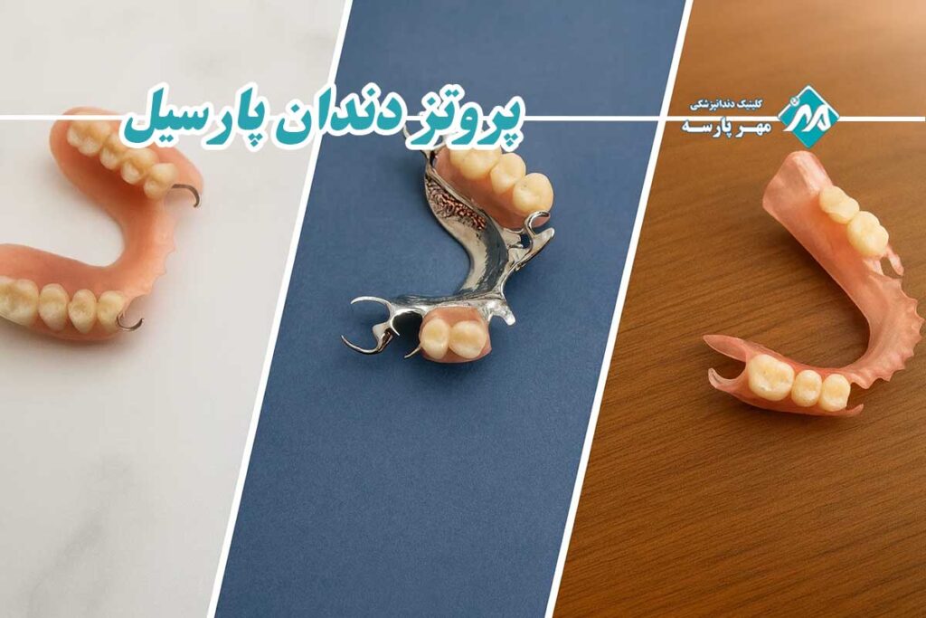 پروتز دندان پارسیل