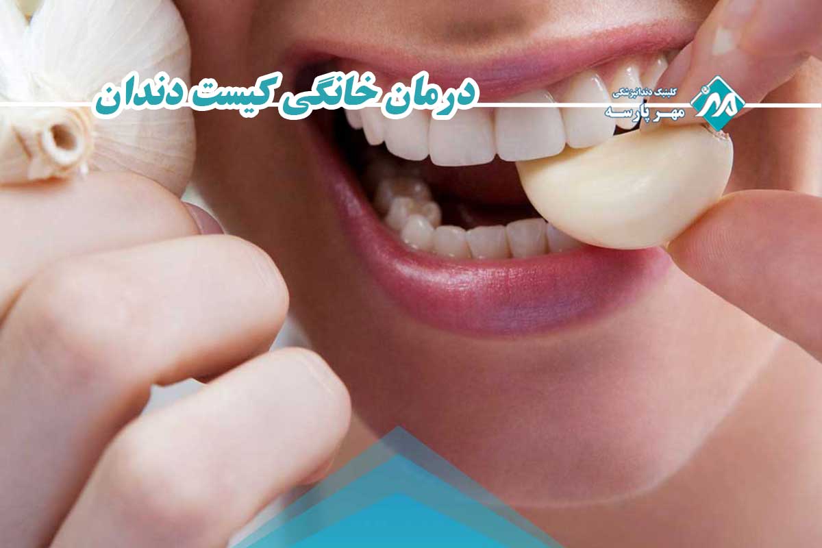 ۶ راهکار علمی و ایمن برای تسکین و درمان خانگی کیست دندان
