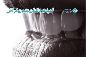 لمینت دندان بدون تراش