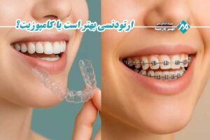 ارتودنسی بهتر است یا کامپوزیت؟