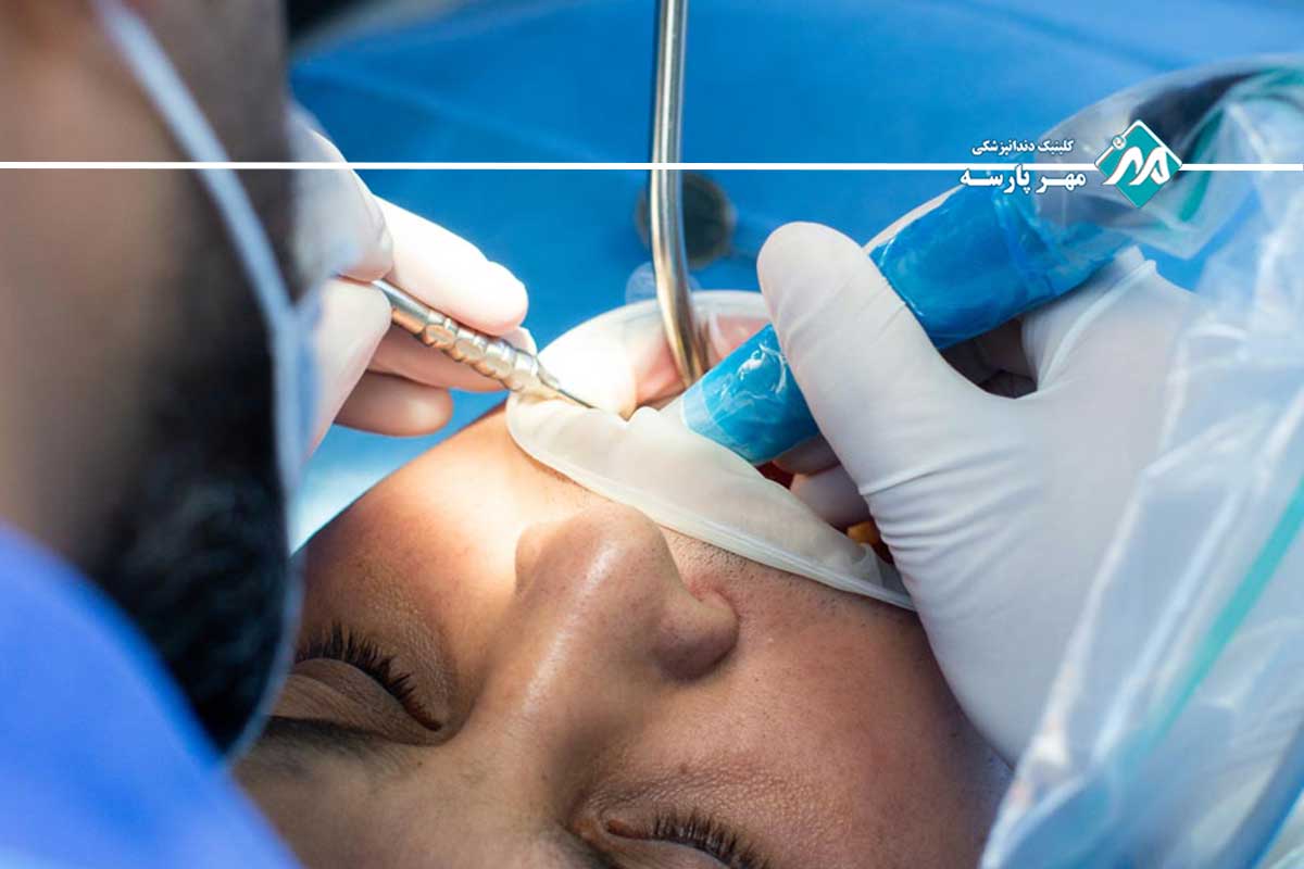 دوران نقاهت طلایی و مراقبت‌های حیاتی پس از جراحی دندان عقل