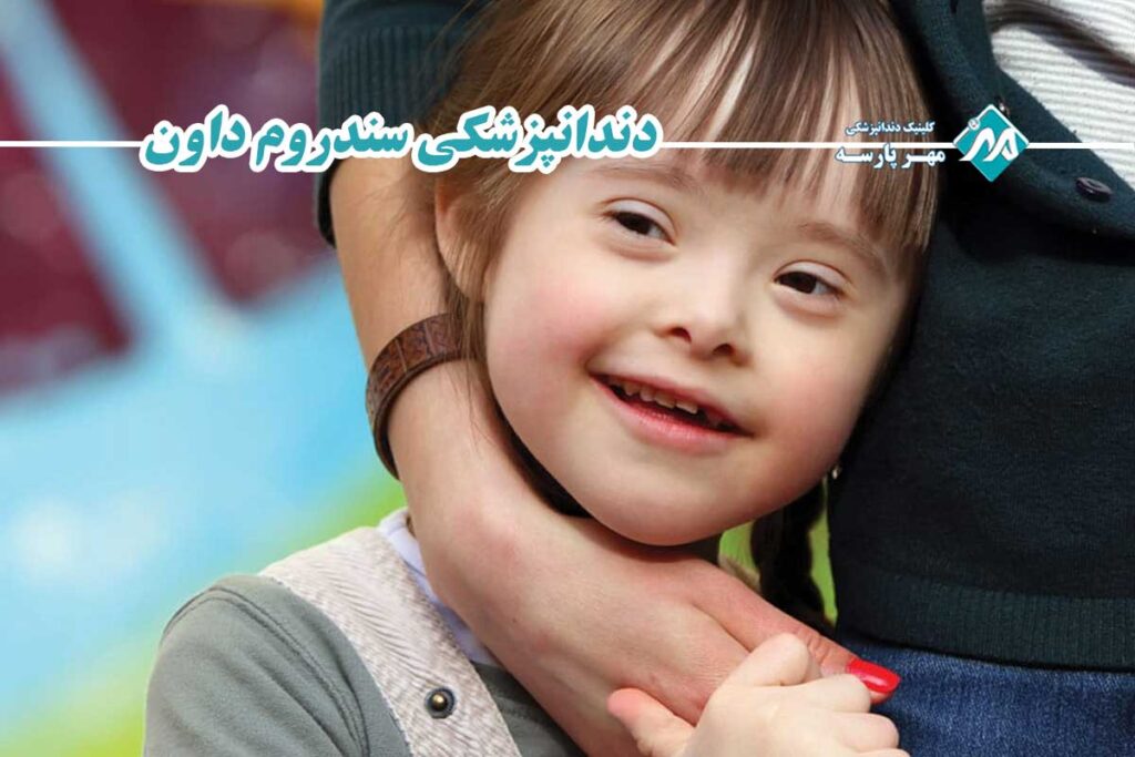 دندانپزشکی سندروم داون