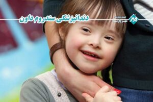 دندانپزشکی سندروم داون