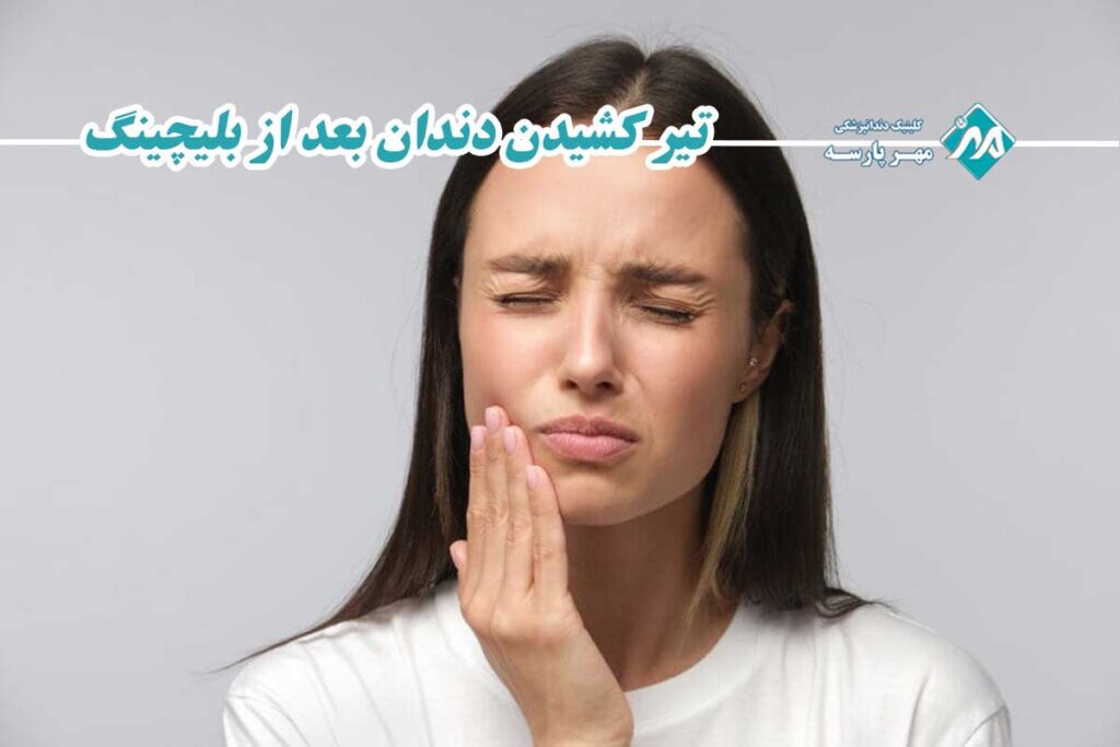 تیر کشیدن دندان بعد از بلیچینگ