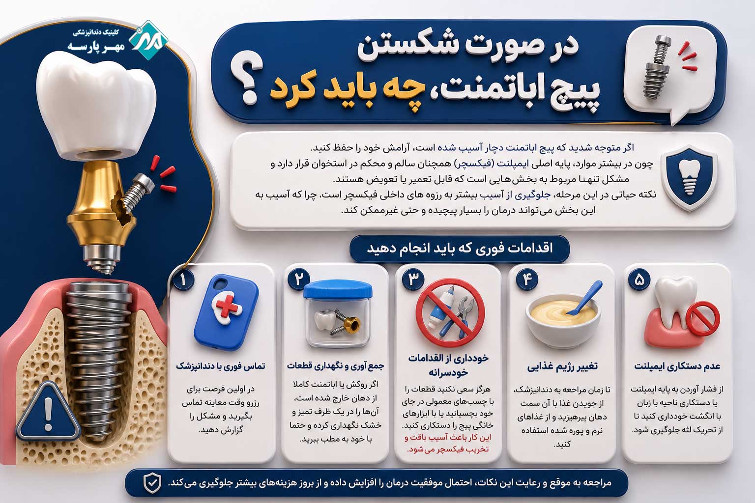 اقدامات لازم در صورت شکستن پیچ اباتمنت