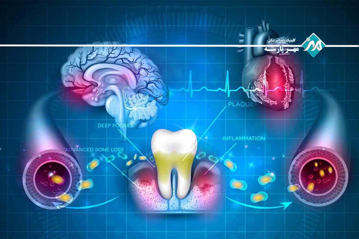 بیماریهای سیستمیک در خونریزی لثه