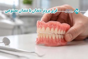 فرق پروتز دندان با دندان مصنوعی
