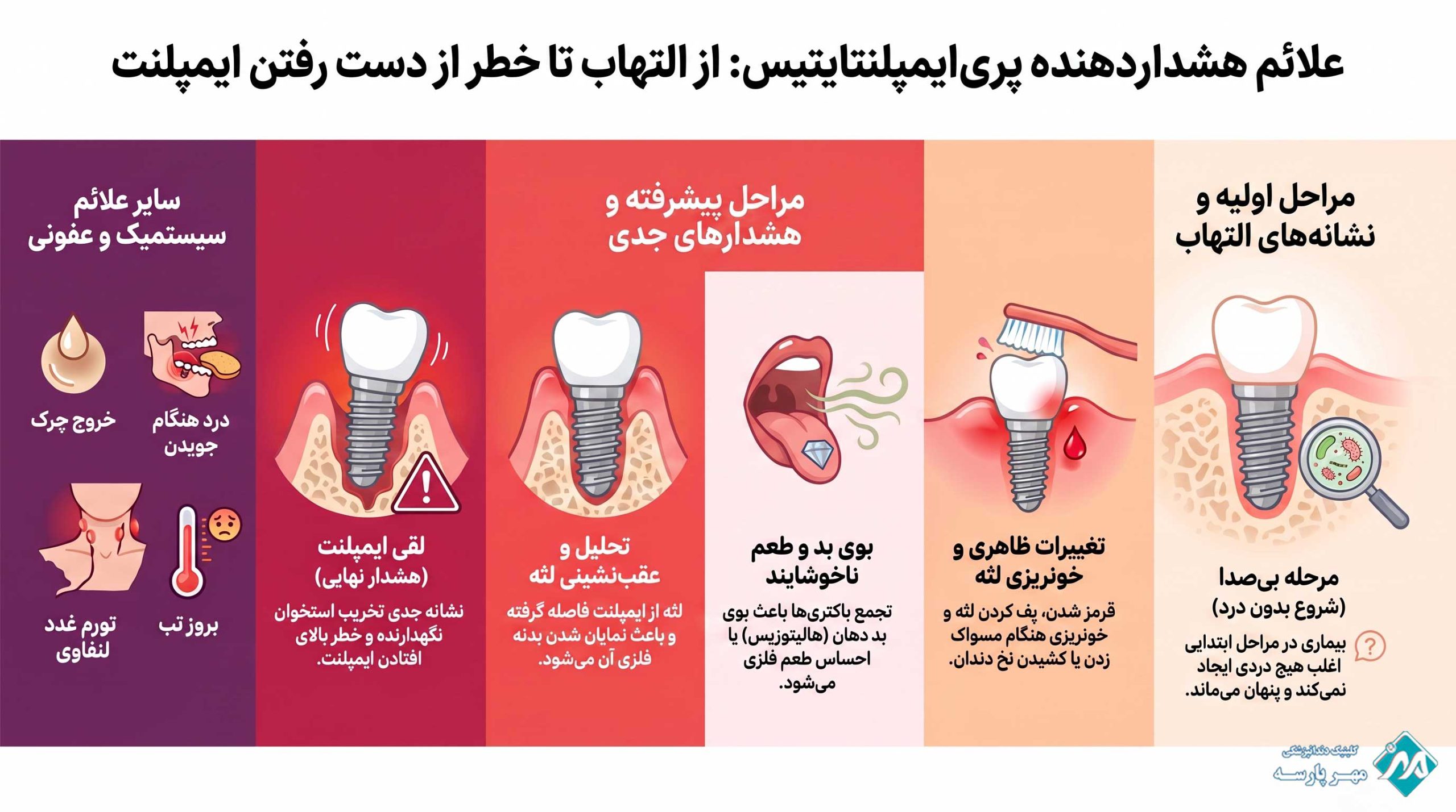 علائم هشداردهنده پریایمپلنتایتیس