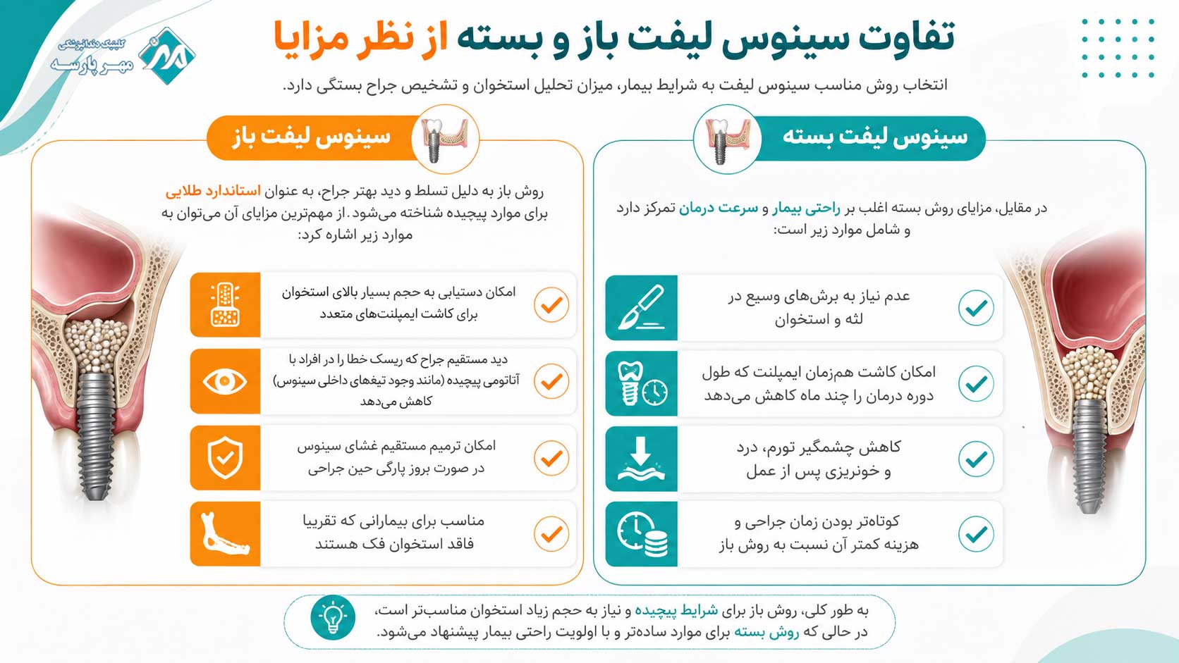 مزایا سینوس لیفت باز و بسته