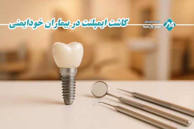 کاشت ایمپلنت در بیماران خودایمنی