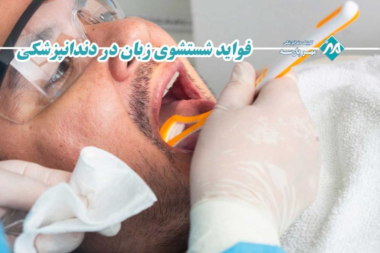 کلینیک دندانپزشکی مهرپارسه 54 شستشوی زبان در دندانپزشکی