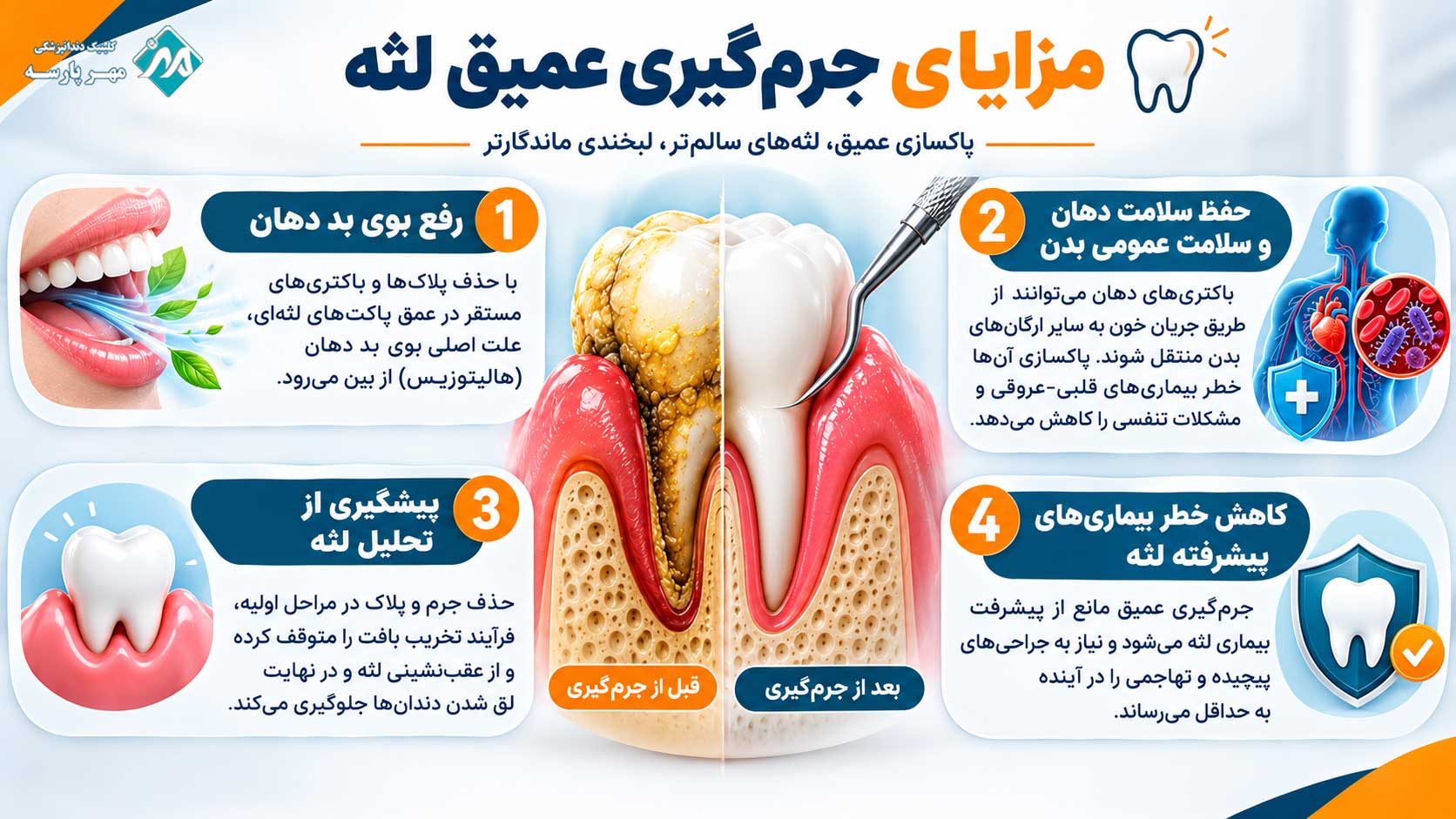 جرمگیری عمیق لثه چیست و چگونه انجام میشود؟ 2 مزایای جرمگیری عمیق لثه