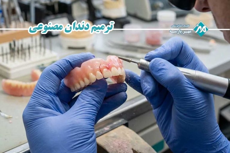 ترمیم دندان مصنوعی