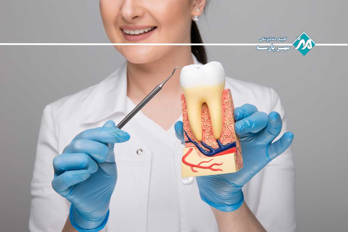 جرمگیری عمیق لثه چیست و چگونه انجام میشود؟ 4 مدت زمان جرمگیری عمیق لثه