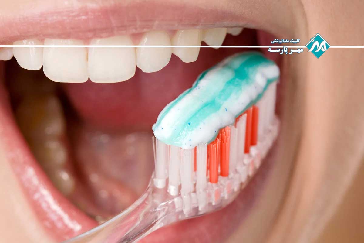 جرمگیری عمیق لثه چیست و چگونه انجام میشود؟ 5 پیشگیری از بیماری لثه