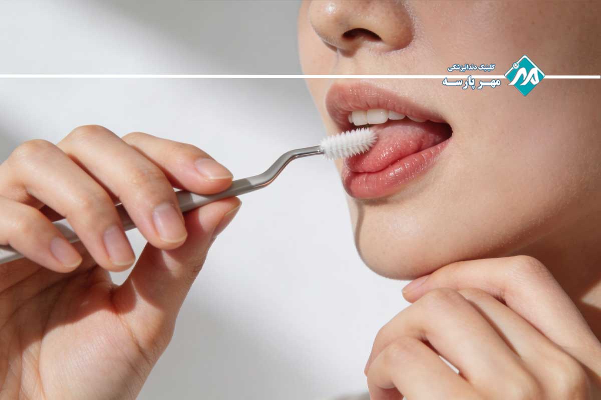 فواید شستشوی زبان در دندانپزشکی 2 شستشوی تخصصی زبان