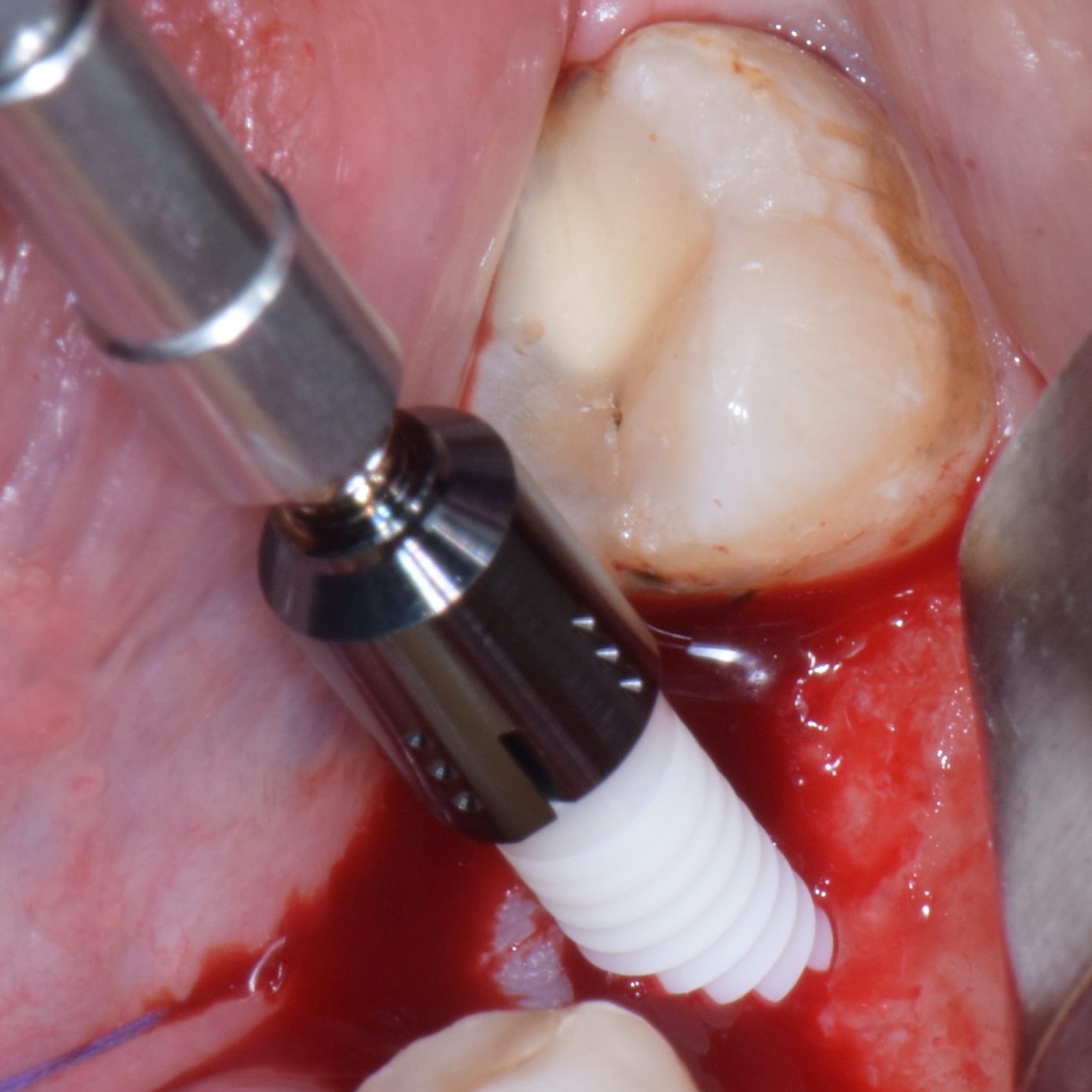 Fig-2-scaled